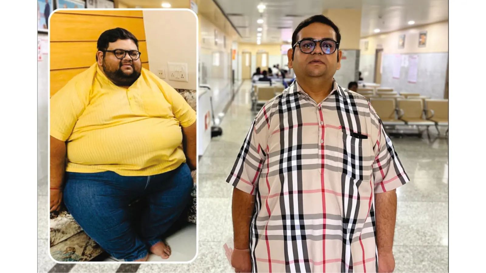 NOBESITY Surgery Helps Ahmedabad Resident Lose 109 Kg, Transforming Health and Life