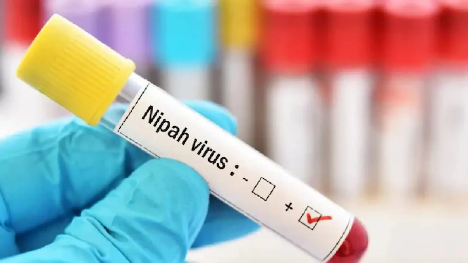 Nipah virus confirmed in bat samples in Kerala, 14-year-old teenager died due to infection