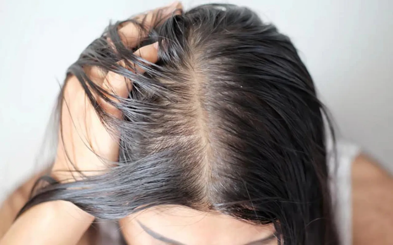 Want to keep oil-free hair in winter? Follow some easy steps for these home remedies