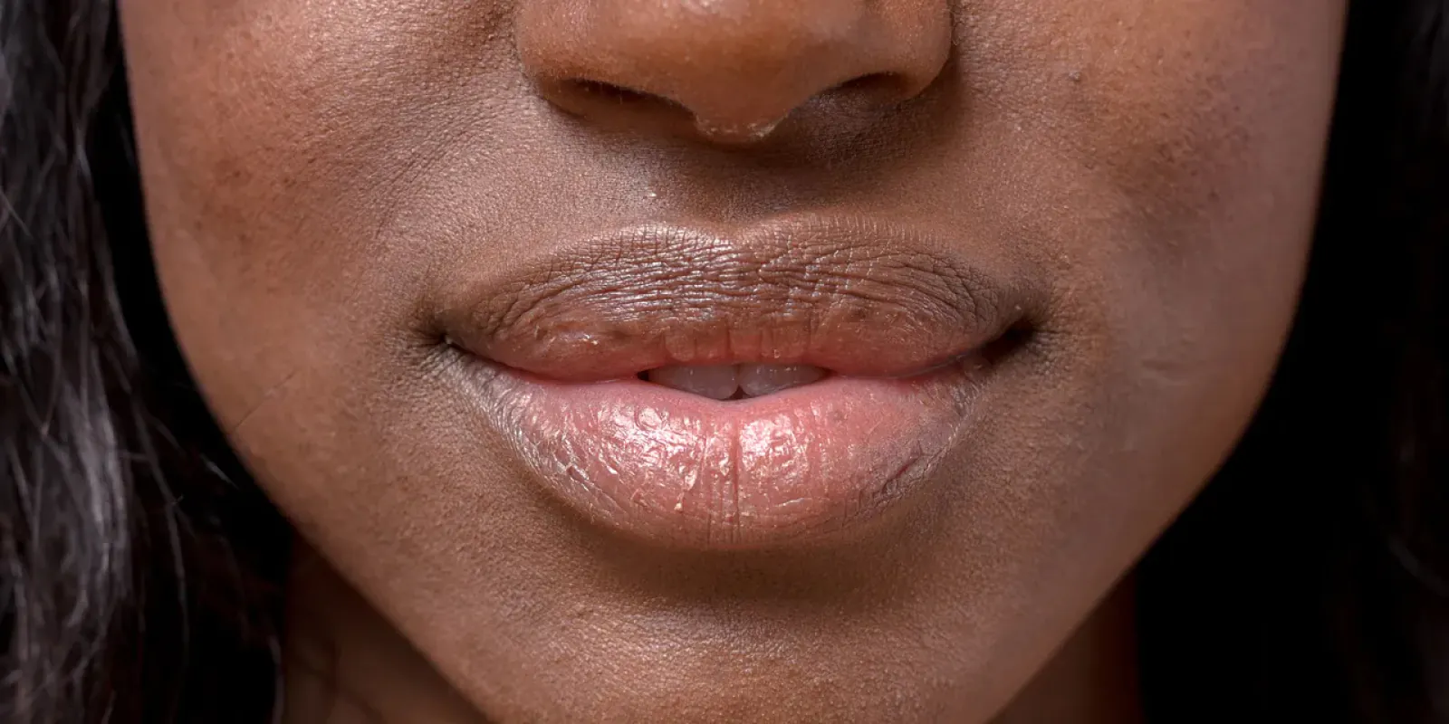 Some winter care tips for soft lips for your dry and flaky due to cold winds