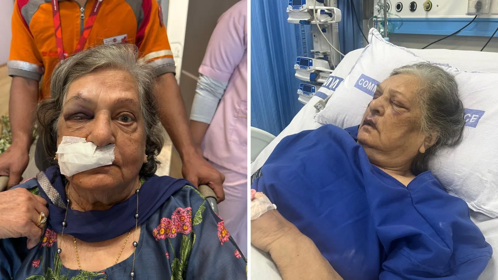 Air India clarification on passenger claiming an 82-year-old woman fell and reached ICU as she was not given a wheelchair